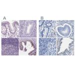 Prostein Antibody in Immunohistochemistry (IHC)