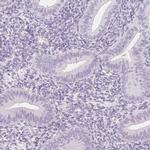 Prostein Antibody in Immunohistochemistry (IHC)