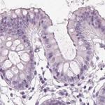 Prostein Antibody in Immunohistochemistry (IHC)