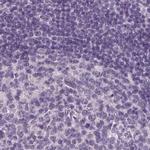 Prostein Antibody in Immunohistochemistry (IHC)