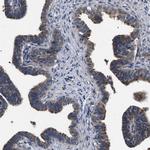 IFT81 Antibody in Immunohistochemistry (IHC)