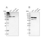 Nuclear Matrix Protein p84 Antibody in Western Blot (WB)