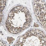 JTV-1 Antibody in Immunohistochemistry (IHC)