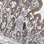 JTV-1 Antibody in Immunohistochemistry (IHC)