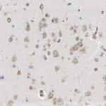 JTV-1 Antibody in Immunohistochemistry (IHC)