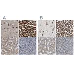 UQCRC2 Antibody in Immunohistochemistry (IHC)