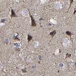 UQCRC2 Antibody in Immunohistochemistry (IHC)