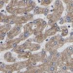 UQCRC2 Antibody in Immunohistochemistry (IHC)