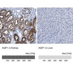 Aquaporin 1 Antibody in Immunohistochemistry (IHC)