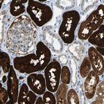 GDA Antibody in Immunohistochemistry (IHC)