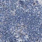 GDA Antibody in Immunohistochemistry (IHC)