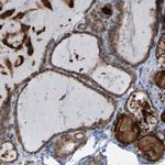 CROT Antibody in Immunohistochemistry (IHC)