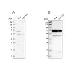 CROT Antibody in Western Blot (WB)