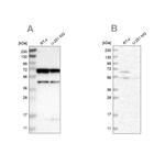 CROT Antibody in Western Blot (WB)