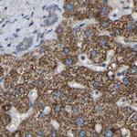 GCC1 Antibody in Immunohistochemistry (IHC)