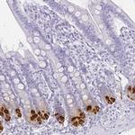 Defensin 6 Antibody in Immunohistochemistry (IHC)