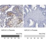 HAPLN1 Antibody in Immunohistochemistry (IHC)