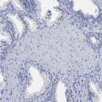 HAPLN1 Antibody in Immunohistochemistry (IHC)