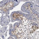 HAPLN1 Antibody in Immunohistochemistry (IHC)