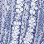 HAPLN1 Antibody in Immunohistochemistry (IHC)