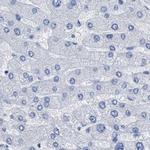 HAPLN1 Antibody in Immunohistochemistry (IHC)