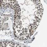 ING2 Antibody in Immunohistochemistry (IHC)