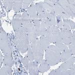 S100P Antibody in Immunohistochemistry (IHC)