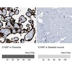 S100P Antibody