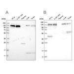 ERC1 Antibody in Western Blot (WB)