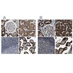 HIBADH Antibody in Immunohistochemistry (IHC)