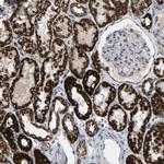 HIBADH Antibody in Immunohistochemistry (IHC)