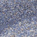 HIBADH Antibody in Immunohistochemistry (IHC)