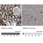 HIBADH Antibody