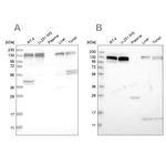 ERC1 Antibody in Western Blot (WB)