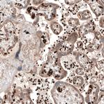 PER3 Antibody in Immunohistochemistry (IHC)