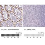 SLC28A1 Antibody