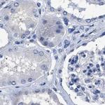 HEMGN Antibody in Immunohistochemistry (IHC)