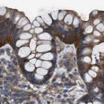 MYO18A Antibody in Immunohistochemistry (IHC)