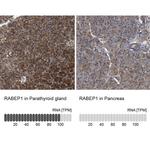 RABEP1 Antibody