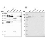 RABEP1 Antibody in Western Blot (WB)