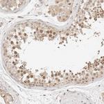 NPAS2 Antibody in Immunohistochemistry (IHC)