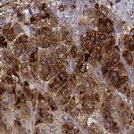 NOV Antibody in Immunohistochemistry (IHC)