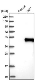 NOV Antibody in Western Blot (WB)