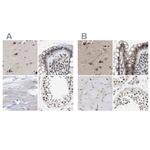 Nuclear Matrix Protein p84 Antibody in Immunohistochemistry (IHC)