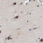 Nuclear Matrix Protein p84 Antibody in Immunohistochemistry (IHC)