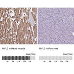 MYL2 Antibody