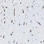 SLC22A15 Antibody in Immunohistochemistry (IHC)