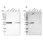 PPA1 Antibody in Western Blot (WB)