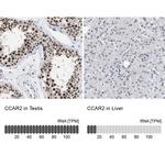 DBC1 Antibody in Immunohistochemistry (IHC)