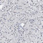 DBC1 Antibody in Immunohistochemistry (IHC)